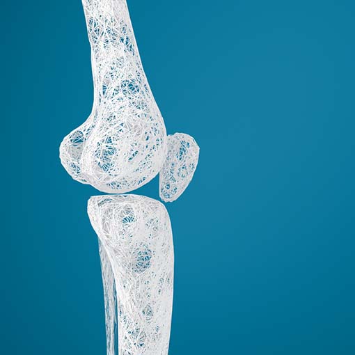 Osteoporose e Problemas de Mobilidade