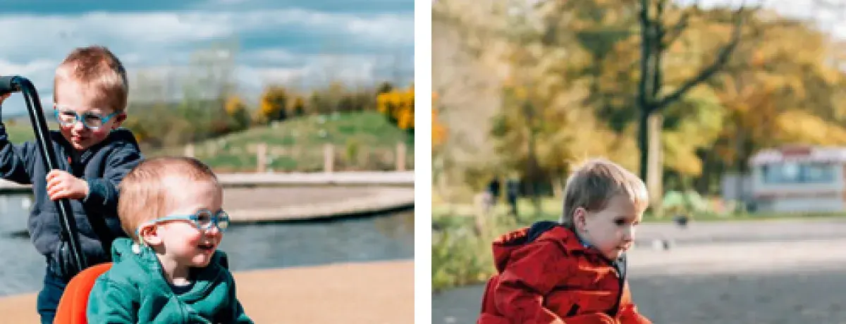 A fisioterapia na Mielomeningoceles